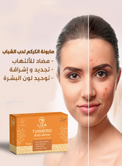 Liza Turmeric Anti-Acne Cleansing Bar 70gm