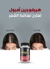 هيرفوجين أمبول (10 امبولات – 10 ملي)